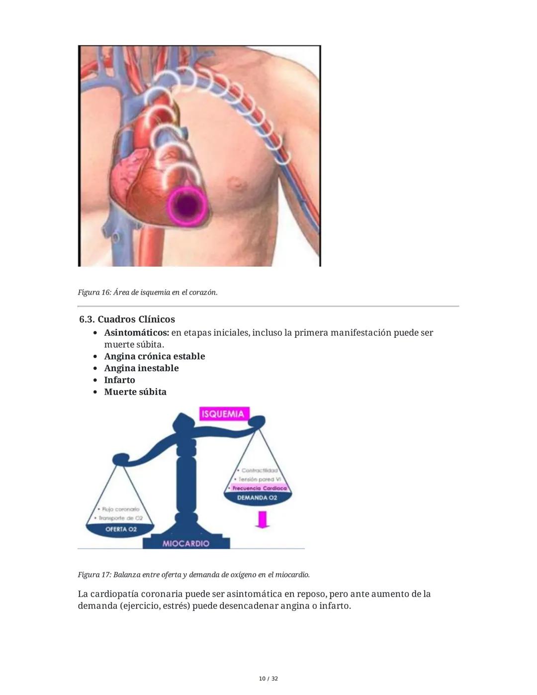 ## Cardiopatía Coronaria

### 1. Introducción y Anatomía de la Circulación Coronaria

La cardiopatía coronaria es una enfermedad crónica del