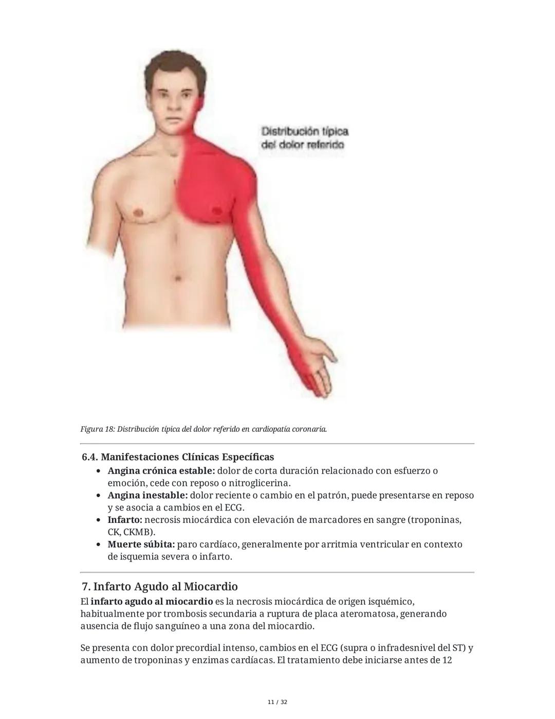 ## Cardiopatía Coronaria

### 1. Introducción y Anatomía de la Circulación Coronaria

La cardiopatía coronaria es una enfermedad crónica del