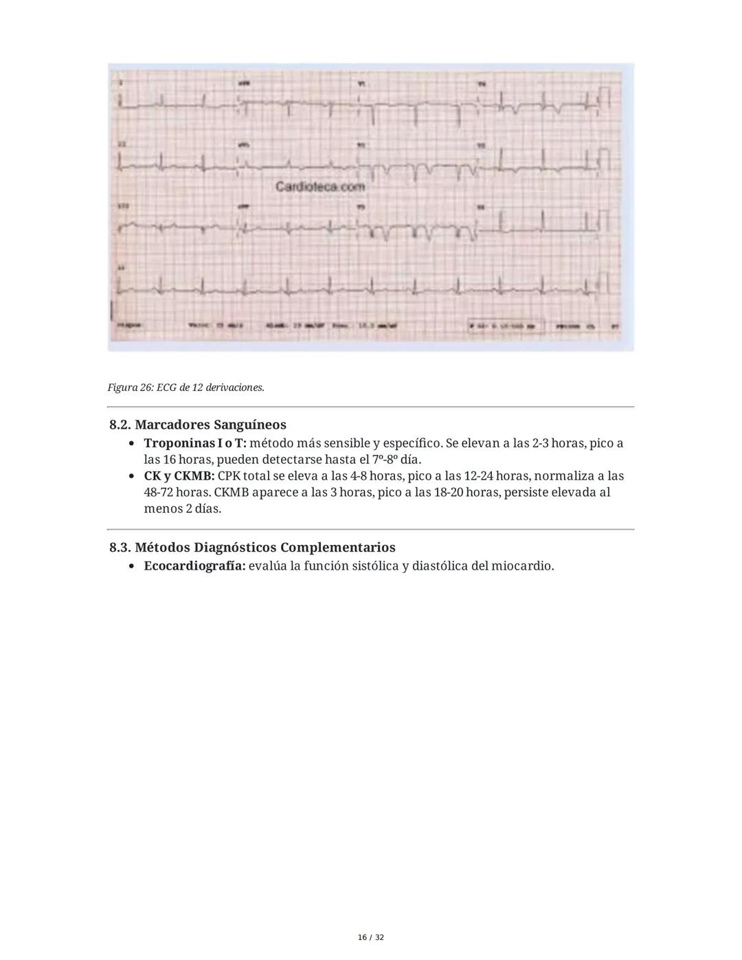 ## Cardiopatía Coronaria

### 1. Introducción y Anatomía de la Circulación Coronaria

La cardiopatía coronaria es una enfermedad crónica del