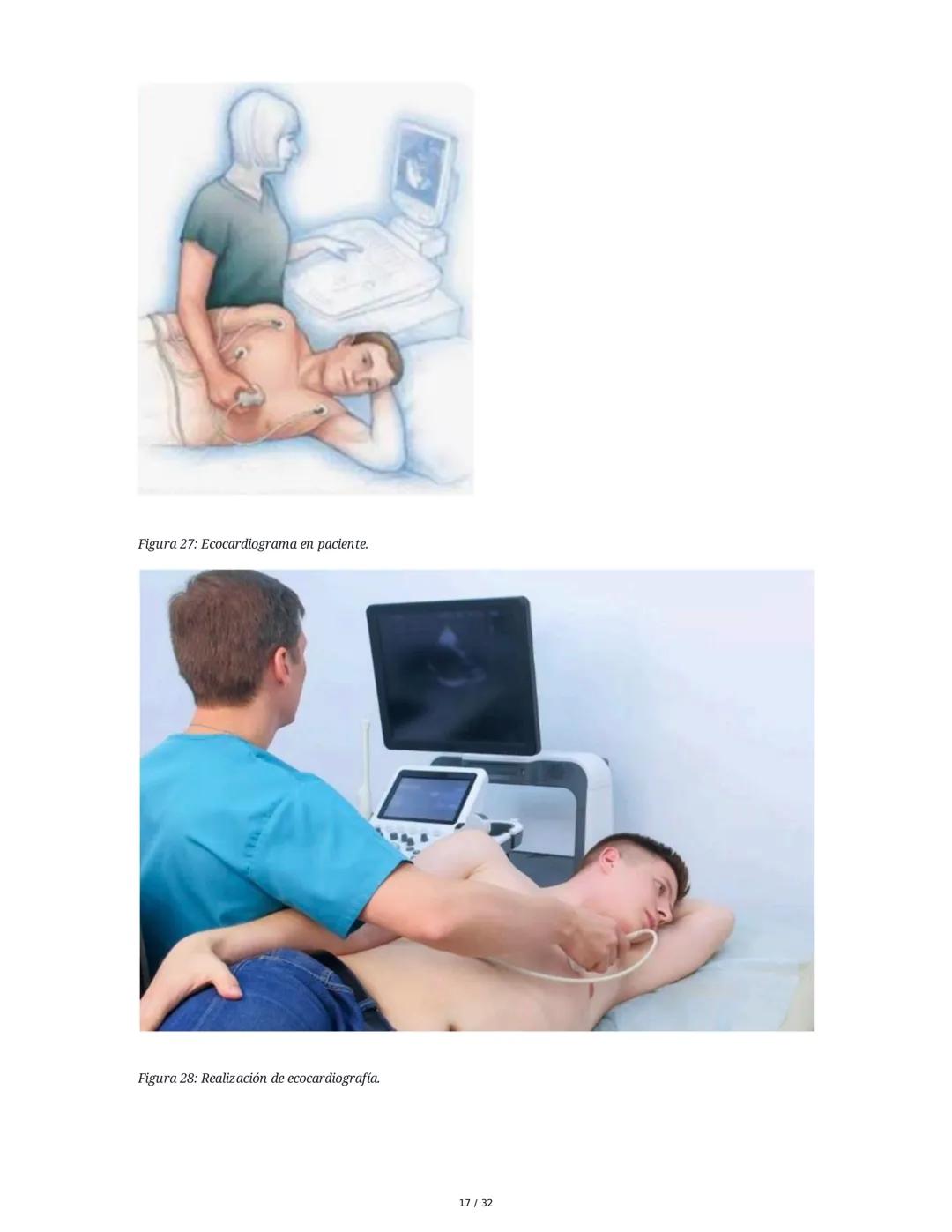 ## Cardiopatía Coronaria

### 1. Introducción y Anatomía de la Circulación Coronaria

La cardiopatía coronaria es una enfermedad crónica del