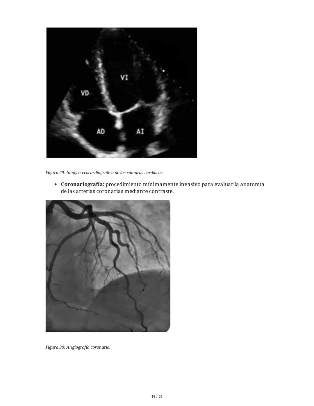 ## Cardiopatía Coronaria

### 1. Introducción y Anatomía de la Circulación Coronaria

La cardiopatía coronaria es una enfermedad crónica del