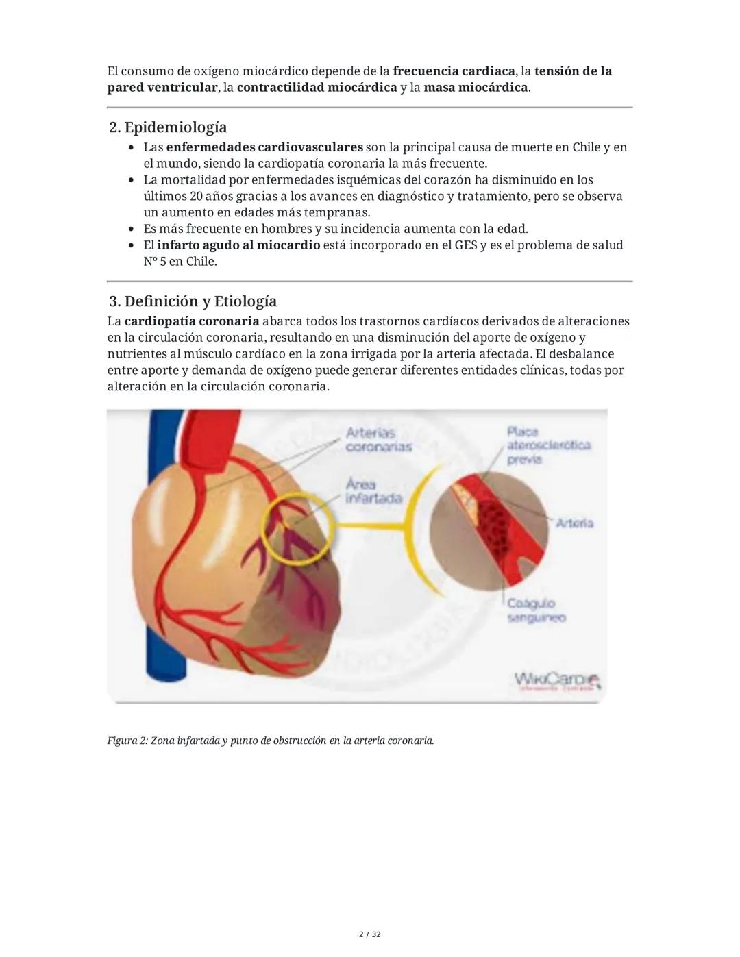 ## Cardiopatía Coronaria

### 1. Introducción y Anatomía de la Circulación Coronaria

La cardiopatía coronaria es una enfermedad crónica del