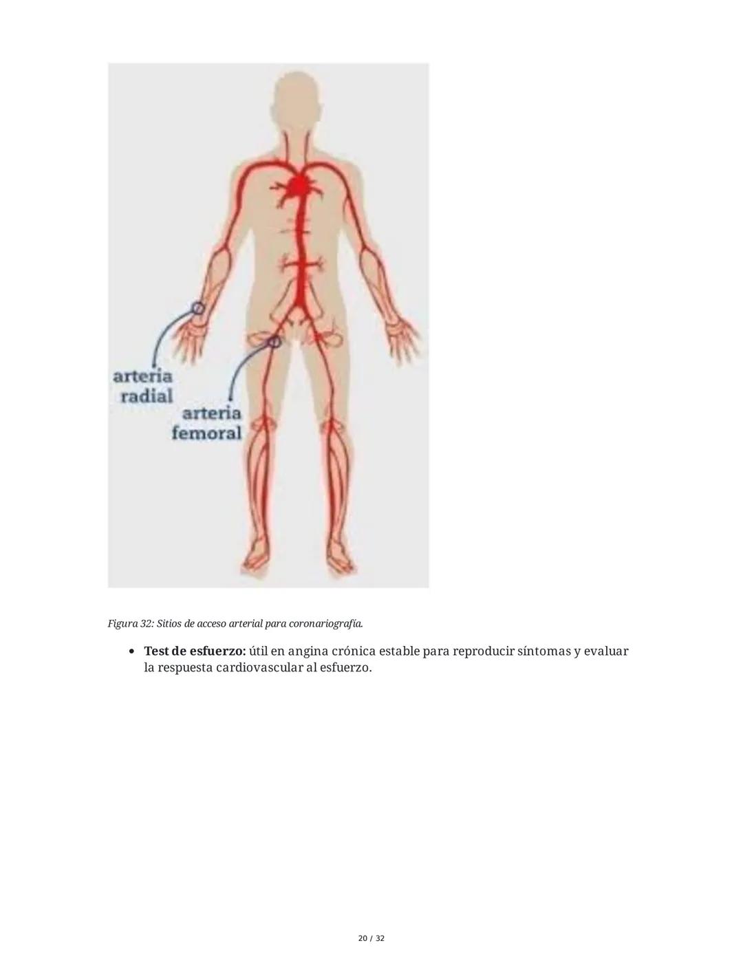 ## Cardiopatía Coronaria

### 1. Introducción y Anatomía de la Circulación Coronaria

La cardiopatía coronaria es una enfermedad crónica del