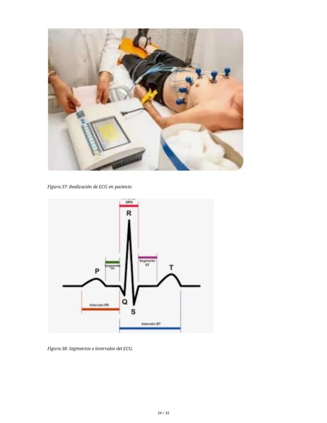 ## Cardiopatía Coronaria

### 1. Introducción y Anatomía de la Circulación Coronaria

La cardiopatía coronaria es una enfermedad crónica del