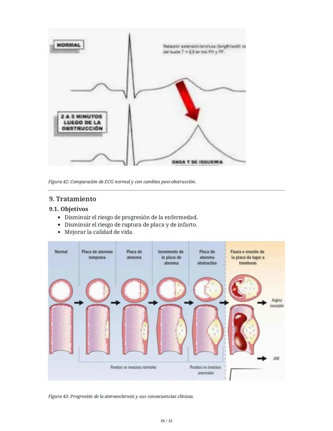## Cardiopatía Coronaria

### 1. Introducción y Anatomía de la Circulación Coronaria

La cardiopatía coronaria es una enfermedad crónica del