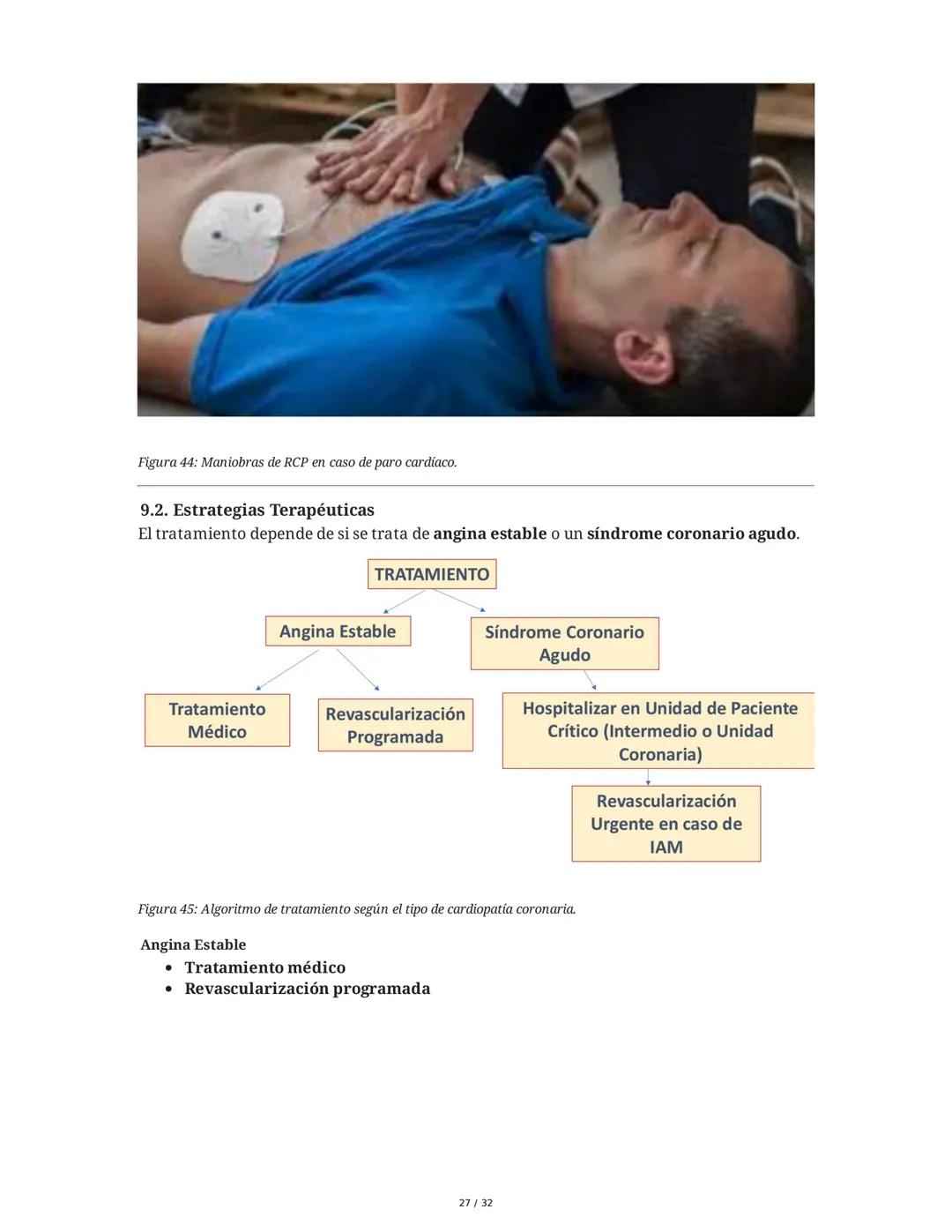 ## Cardiopatía Coronaria

### 1. Introducción y Anatomía de la Circulación Coronaria

La cardiopatía coronaria es una enfermedad crónica del