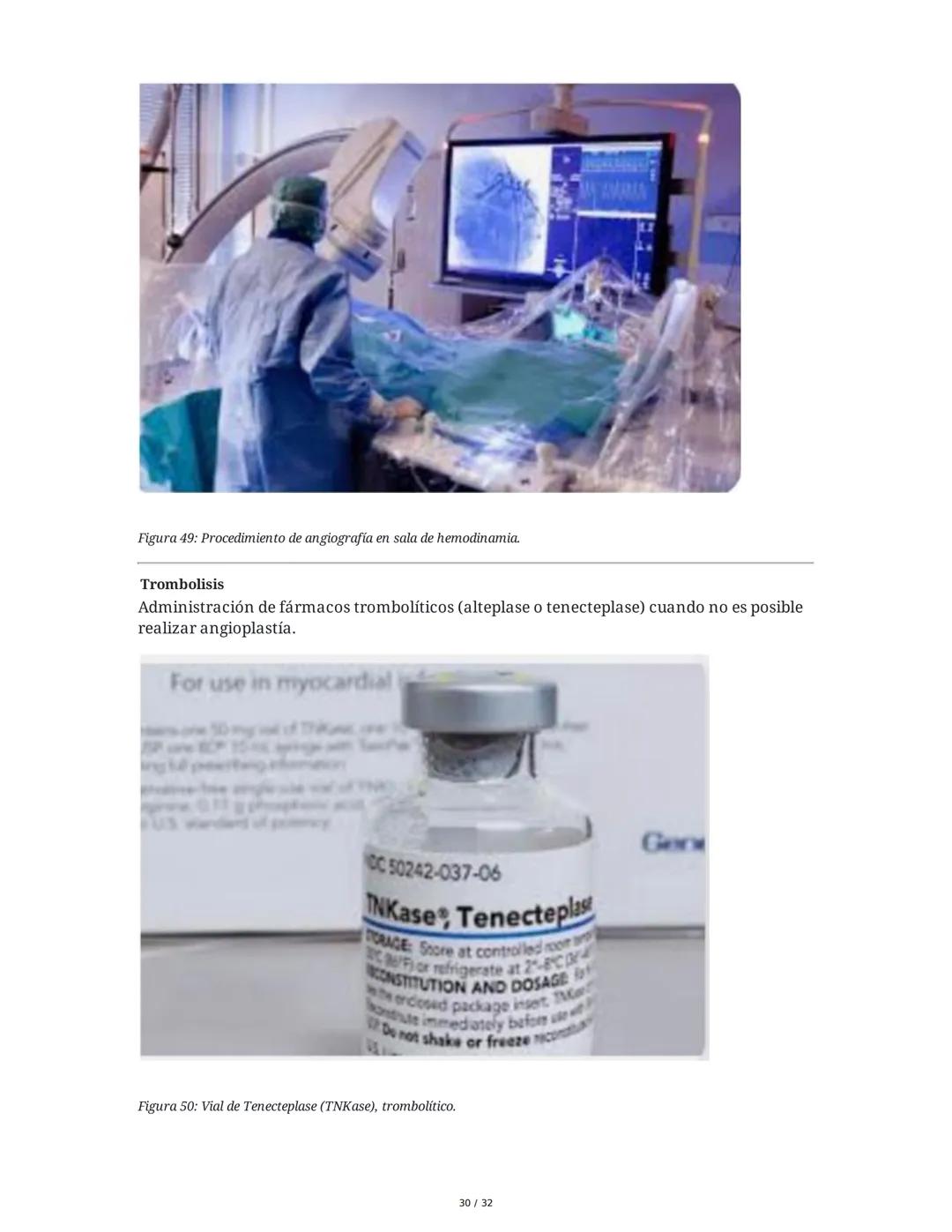 ## Cardiopatía Coronaria

### 1. Introducción y Anatomía de la Circulación Coronaria

La cardiopatía coronaria es una enfermedad crónica del