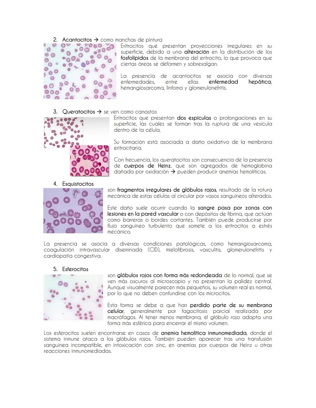 Introducción a la Hematología y evaluación de la serie Roja
Evaluación de la serie roja
Eritropoyesis→ proceso por el cual se producen los g