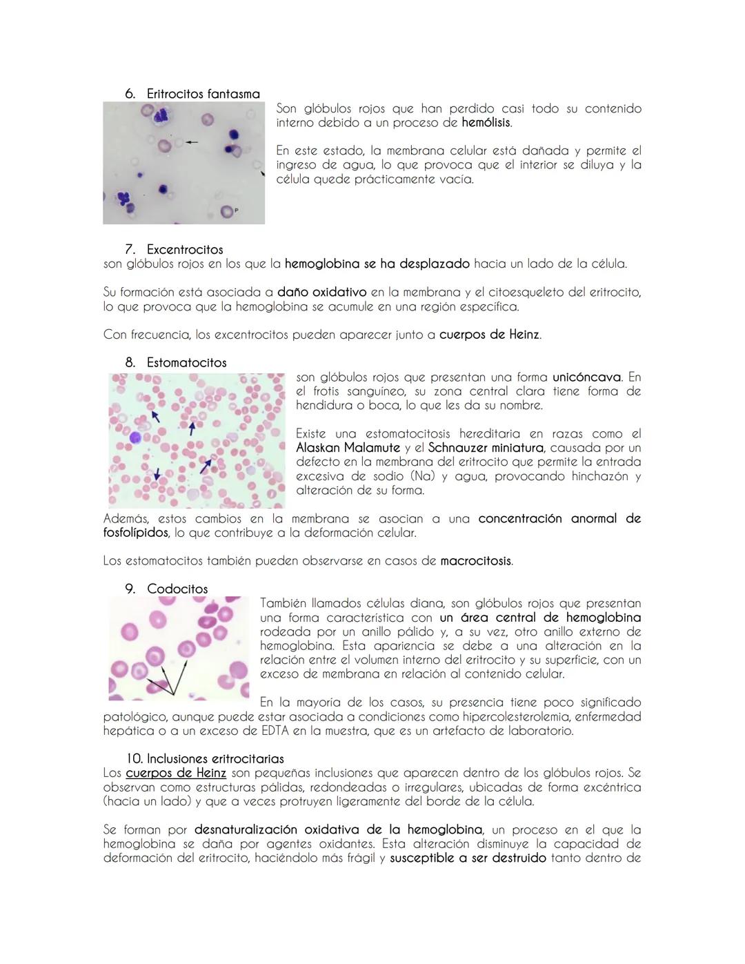 Introducción a la Hematología y evaluación de la serie Roja
Evaluación de la serie roja
Eritropoyesis→ proceso por el cual se producen los g