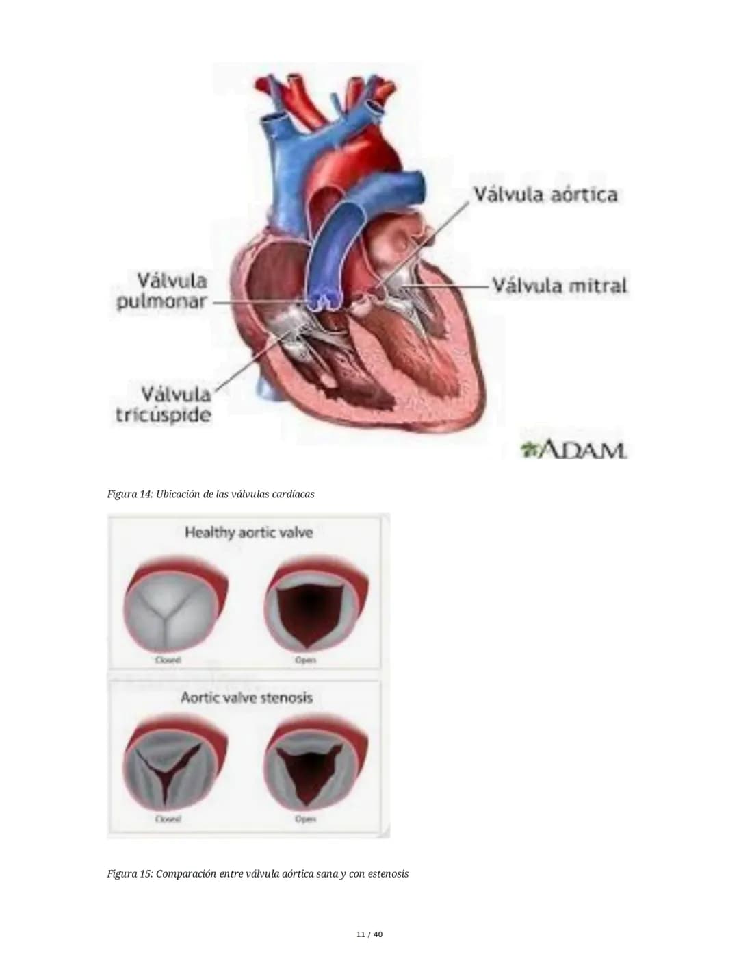 Patologías de las Válvulas Cardiacas
1. Anatomía y Fisiología de las Válvulas Cardiacas
Las válvulas cardíacas son estructuras que permiten 