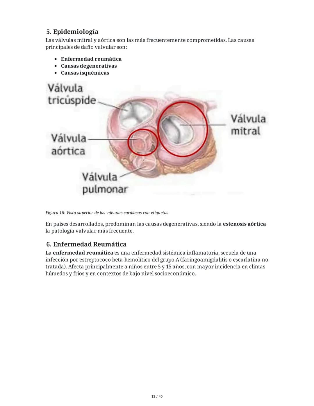 Patologías de las Válvulas Cardiacas
1. Anatomía y Fisiología de las Válvulas Cardiacas
Las válvulas cardíacas son estructuras que permiten 