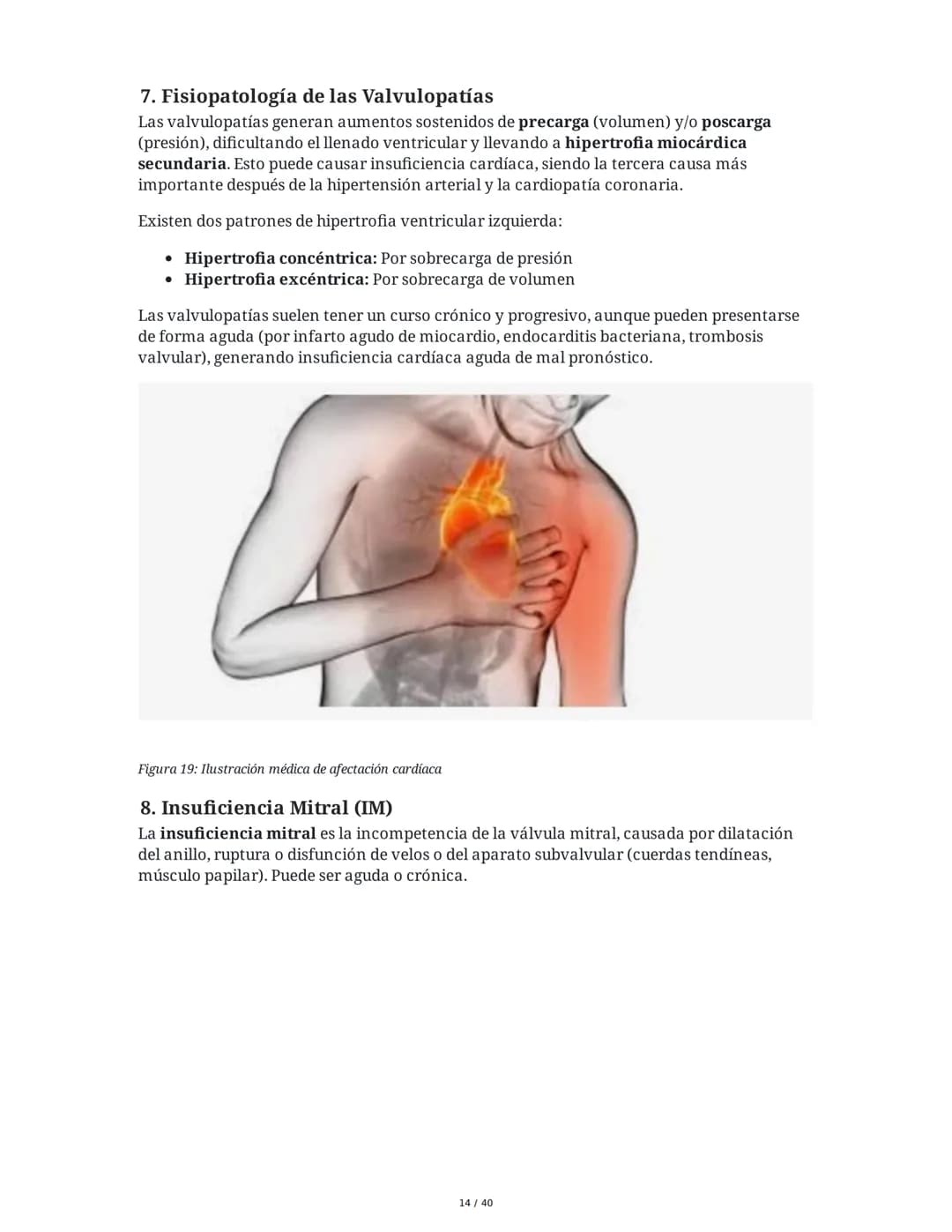 Patologías de las Válvulas Cardiacas
1. Anatomía y Fisiología de las Válvulas Cardiacas
Las válvulas cardíacas son estructuras que permiten 