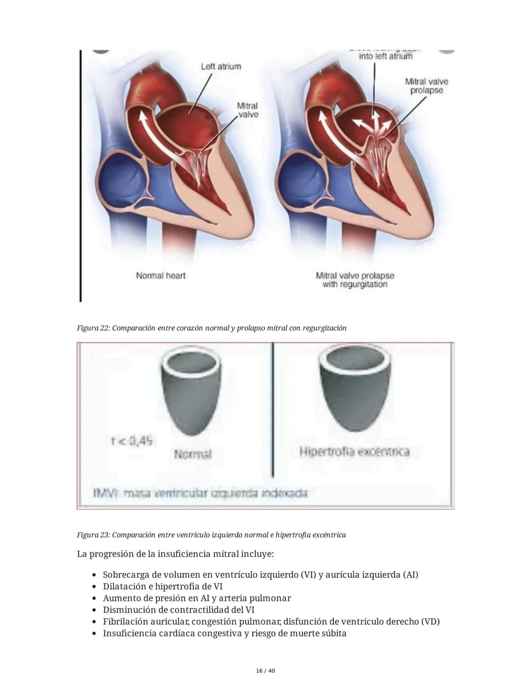 Patologías de las Válvulas Cardiacas
1. Anatomía y Fisiología de las Válvulas Cardiacas
Las válvulas cardíacas son estructuras que permiten 