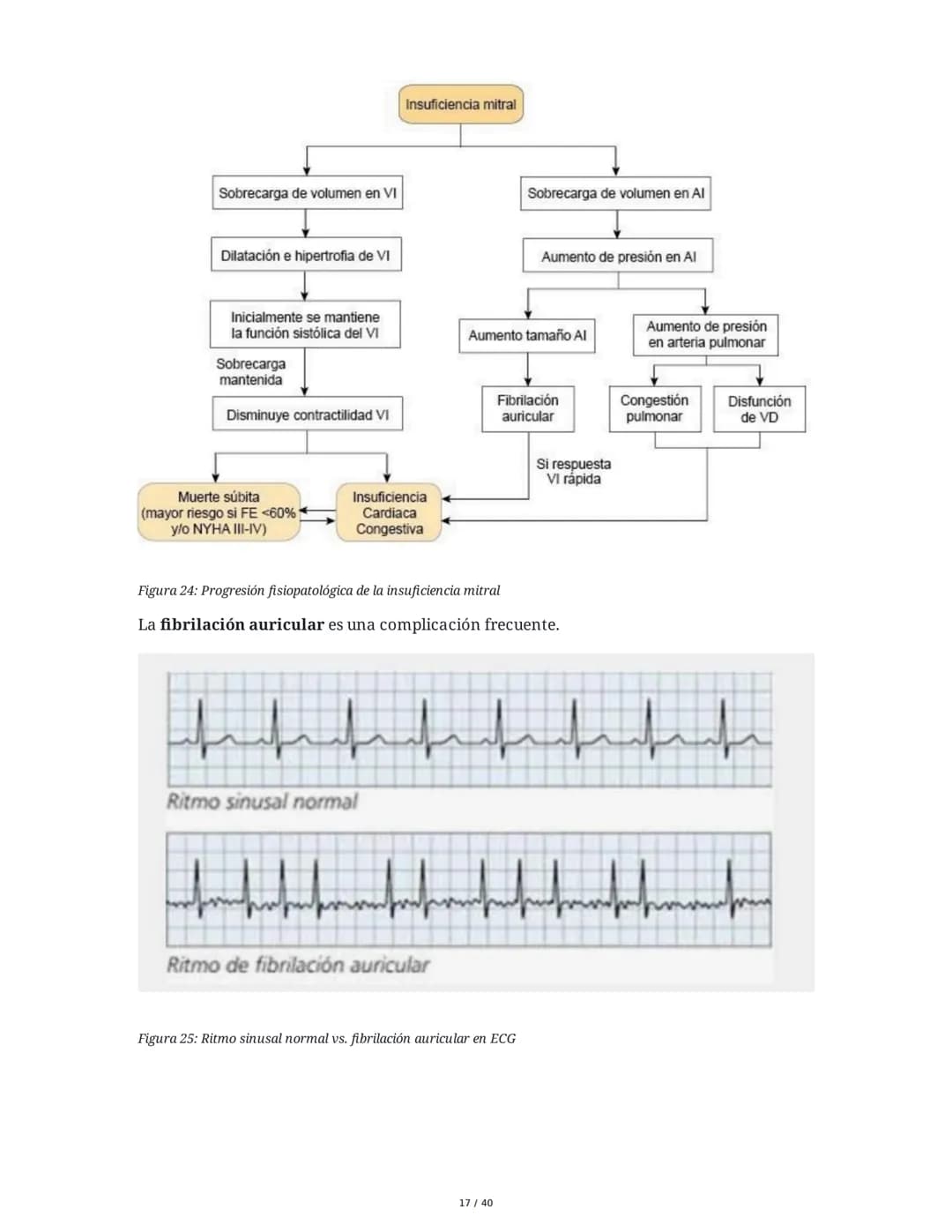 Patologías de las Válvulas Cardiacas
1. Anatomía y Fisiología de las Válvulas Cardiacas
Las válvulas cardíacas son estructuras que permiten 