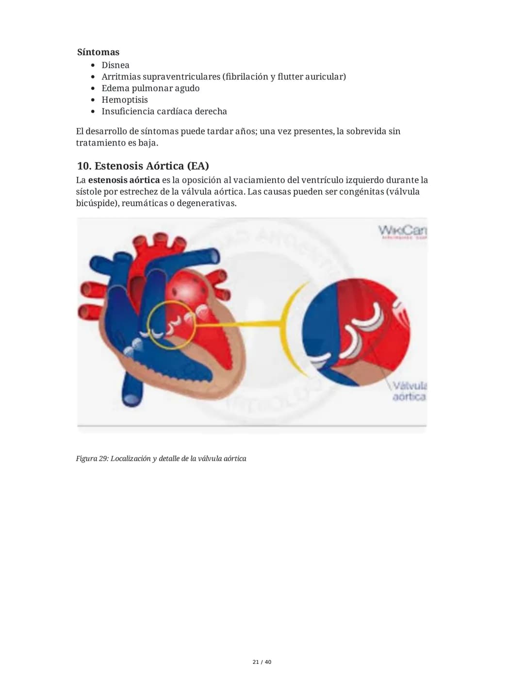 Patologías de las Válvulas Cardiacas
1. Anatomía y Fisiología de las Válvulas Cardiacas
Las válvulas cardíacas son estructuras que permiten 