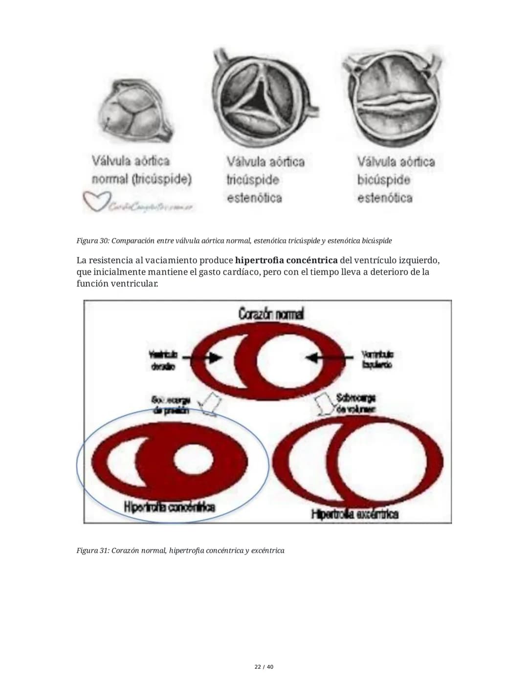 Patologías de las Válvulas Cardiacas
1. Anatomía y Fisiología de las Válvulas Cardiacas
Las válvulas cardíacas son estructuras que permiten 