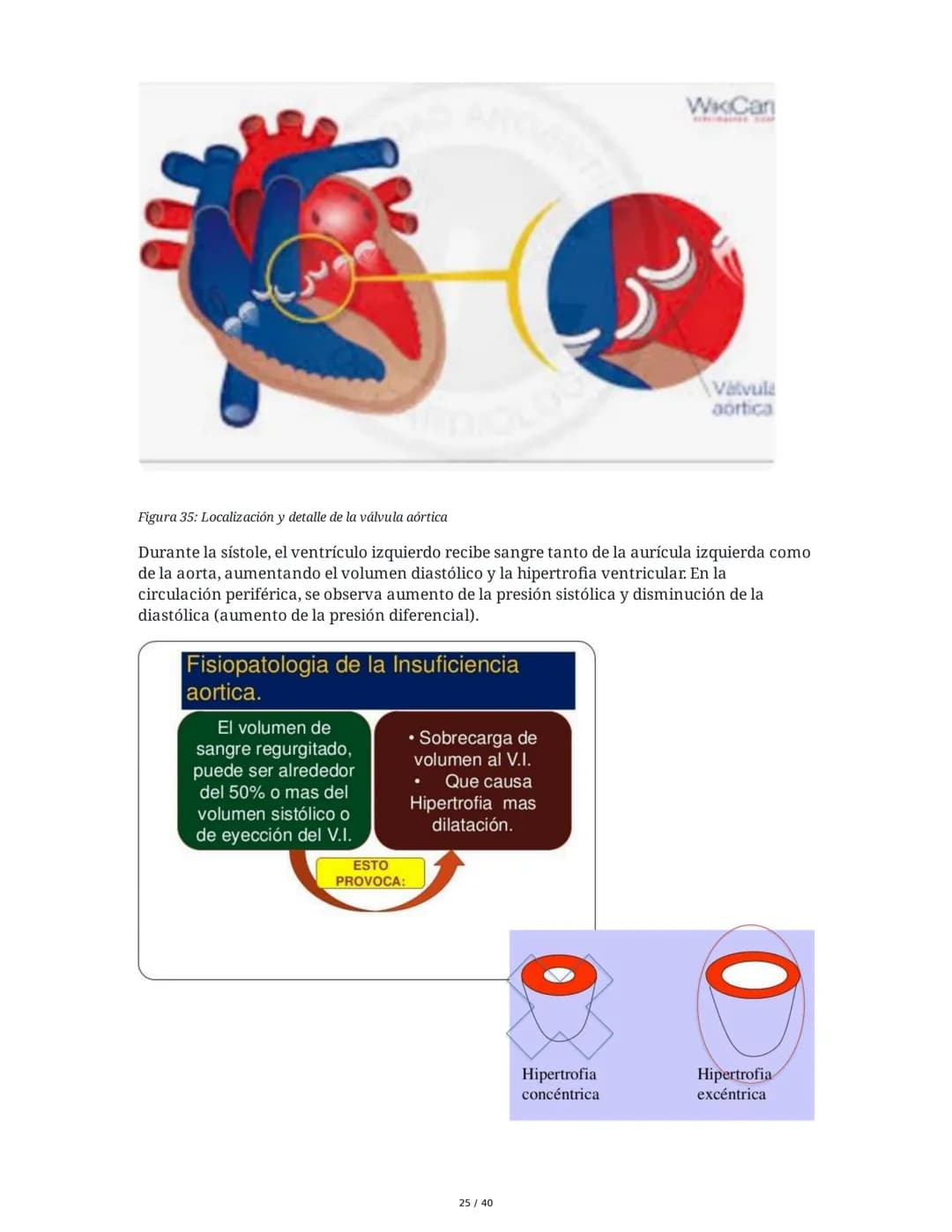 Patologías de las Válvulas Cardiacas
1. Anatomía y Fisiología de las Válvulas Cardiacas
Las válvulas cardíacas son estructuras que permiten 