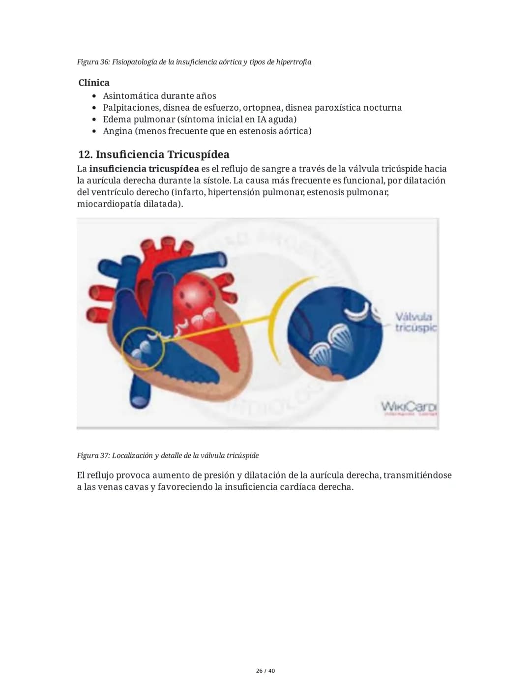 Patologías de las Válvulas Cardiacas
1. Anatomía y Fisiología de las Válvulas Cardiacas
Las válvulas cardíacas son estructuras que permiten 