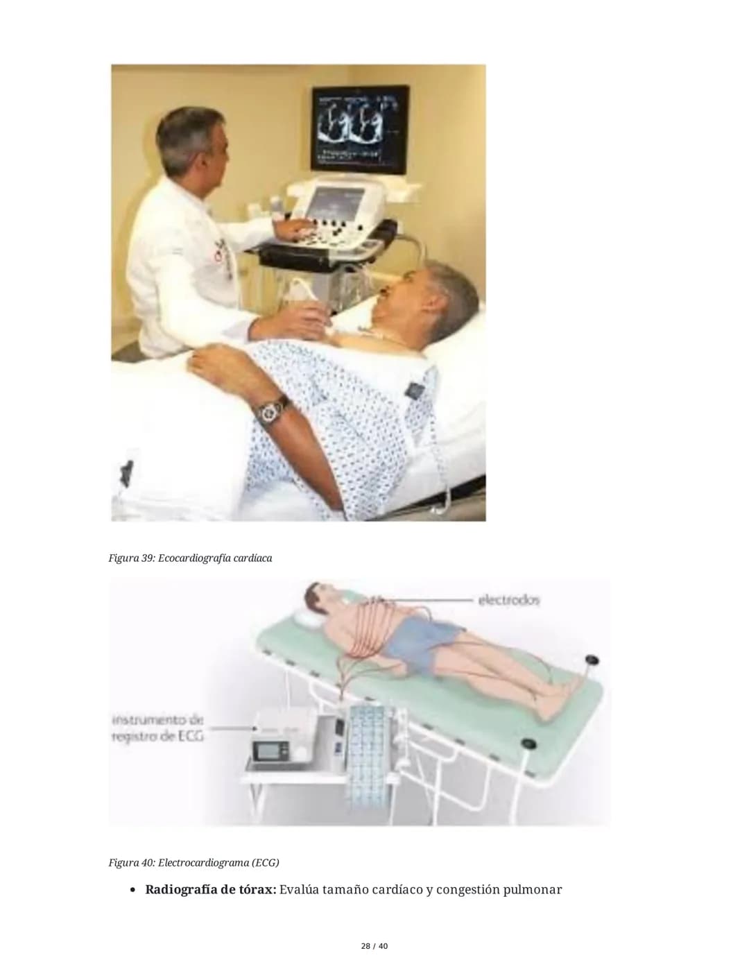 Patologías de las Válvulas Cardiacas
1. Anatomía y Fisiología de las Válvulas Cardiacas
Las válvulas cardíacas son estructuras que permiten 