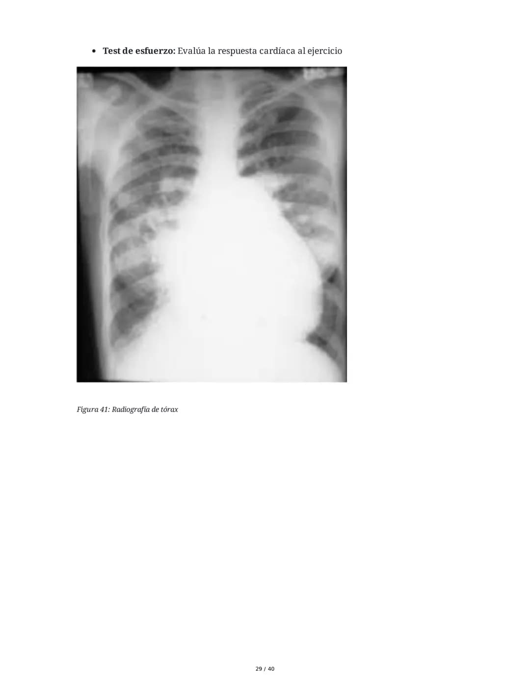 Patologías de las Válvulas Cardiacas
1. Anatomía y Fisiología de las Válvulas Cardiacas
Las válvulas cardíacas son estructuras que permiten 