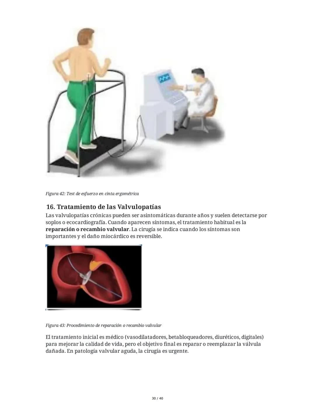 Patologías de las Válvulas Cardiacas
1. Anatomía y Fisiología de las Válvulas Cardiacas
Las válvulas cardíacas son estructuras que permiten 