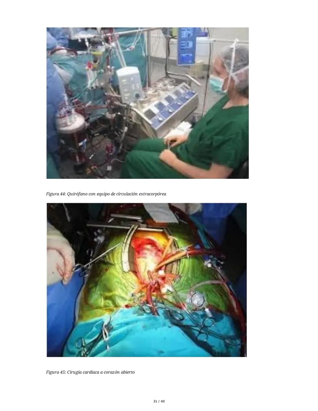 Patologías de las Válvulas Cardiacas
1. Anatomía y Fisiología de las Válvulas Cardiacas
Las válvulas cardíacas son estructuras que permiten 