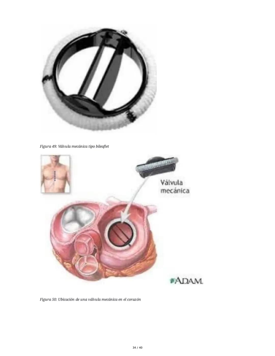 Patologías de las Válvulas Cardiacas
1. Anatomía y Fisiología de las Válvulas Cardiacas
Las válvulas cardíacas son estructuras que permiten 