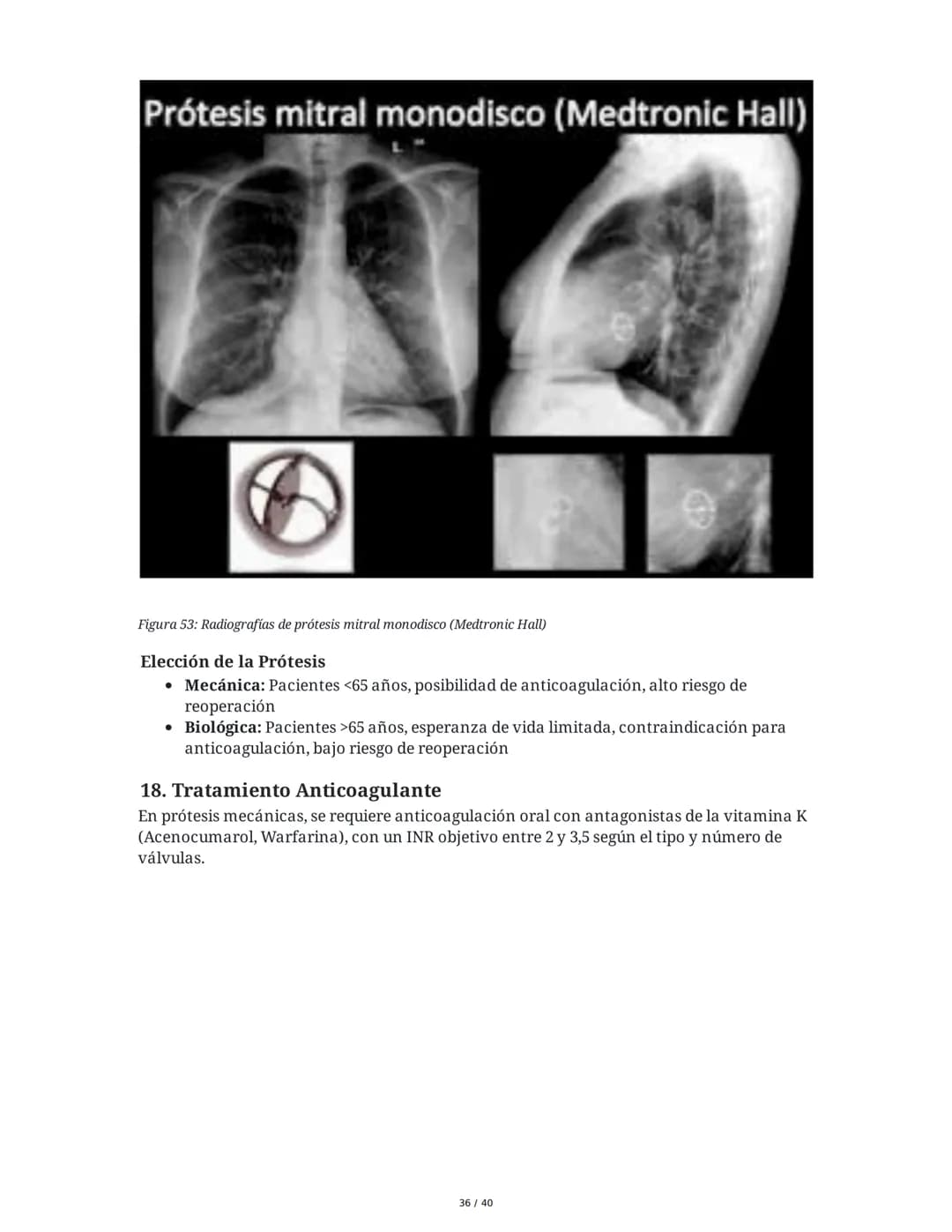 Patologías de las Válvulas Cardiacas
1. Anatomía y Fisiología de las Válvulas Cardiacas
Las válvulas cardíacas son estructuras que permiten 