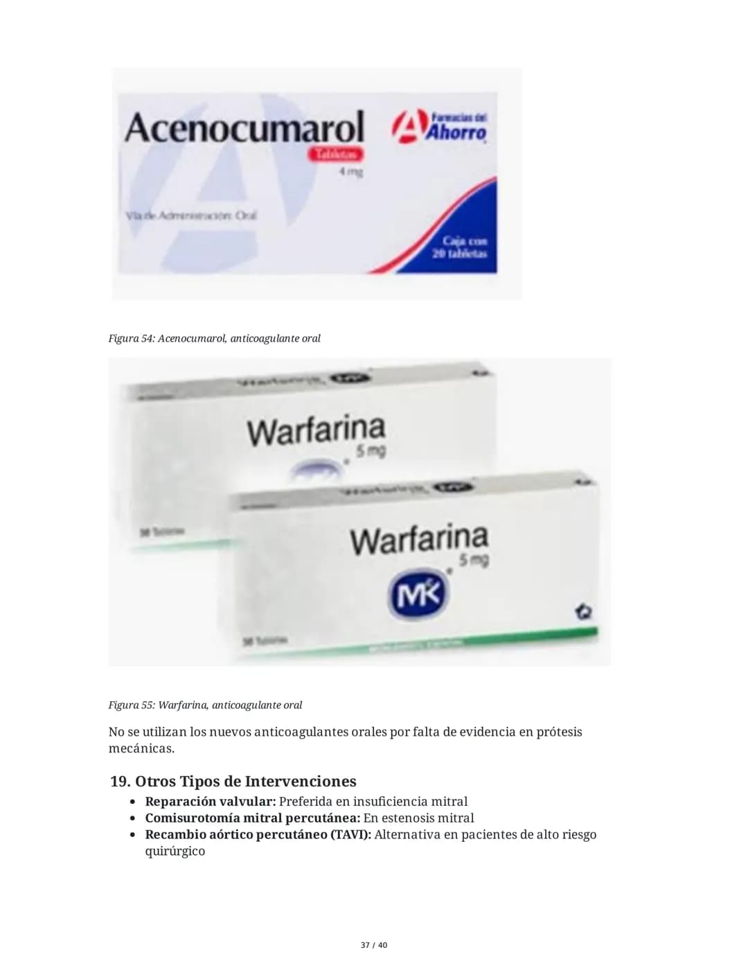 Patologías de las Válvulas Cardiacas
1. Anatomía y Fisiología de las Válvulas Cardiacas
Las válvulas cardíacas son estructuras que permiten 