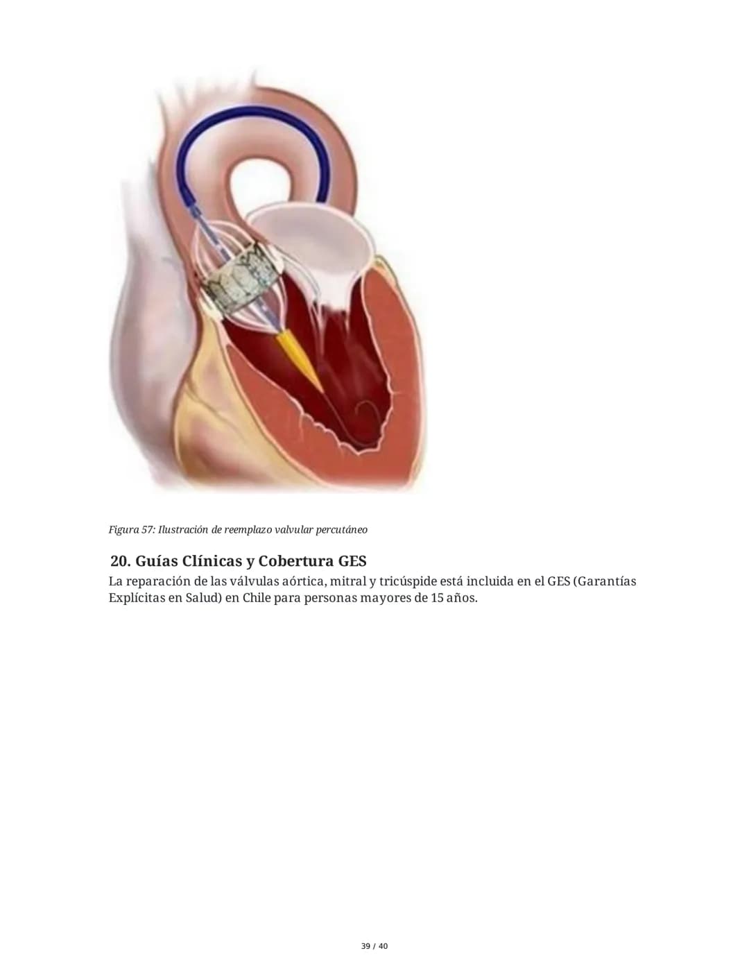 Patologías de las Válvulas Cardiacas
1. Anatomía y Fisiología de las Válvulas Cardiacas
Las válvulas cardíacas son estructuras que permiten 