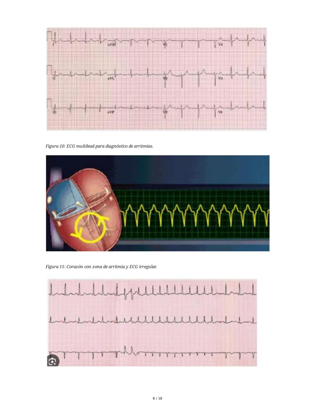 Farmacología Cardiovascular: Inótropos, Antianginosos y
Antiarrítmicos
1. Introducción y Clasificación General
La farmacología cardiovascula