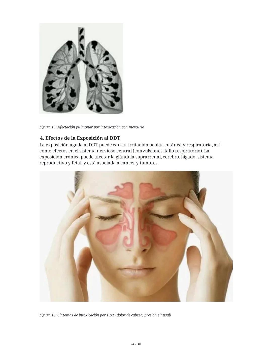 Módulo Ambiente y Sostenibilidad
Concepto: Cambio Climático
1. Impacto del Cambio Climático en el Agua del Planeta
El cambio climático afect