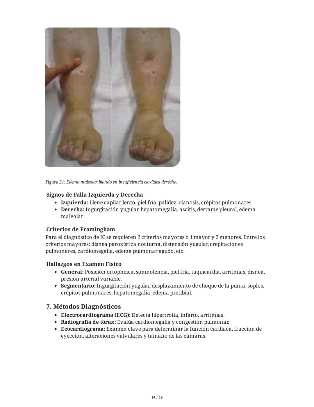 # Insuficiencia Cardiaca

## 1. Introducción y Definición

La insuficiencia cardiaca (IC) es un síndrome clínico complejo y una de las princ