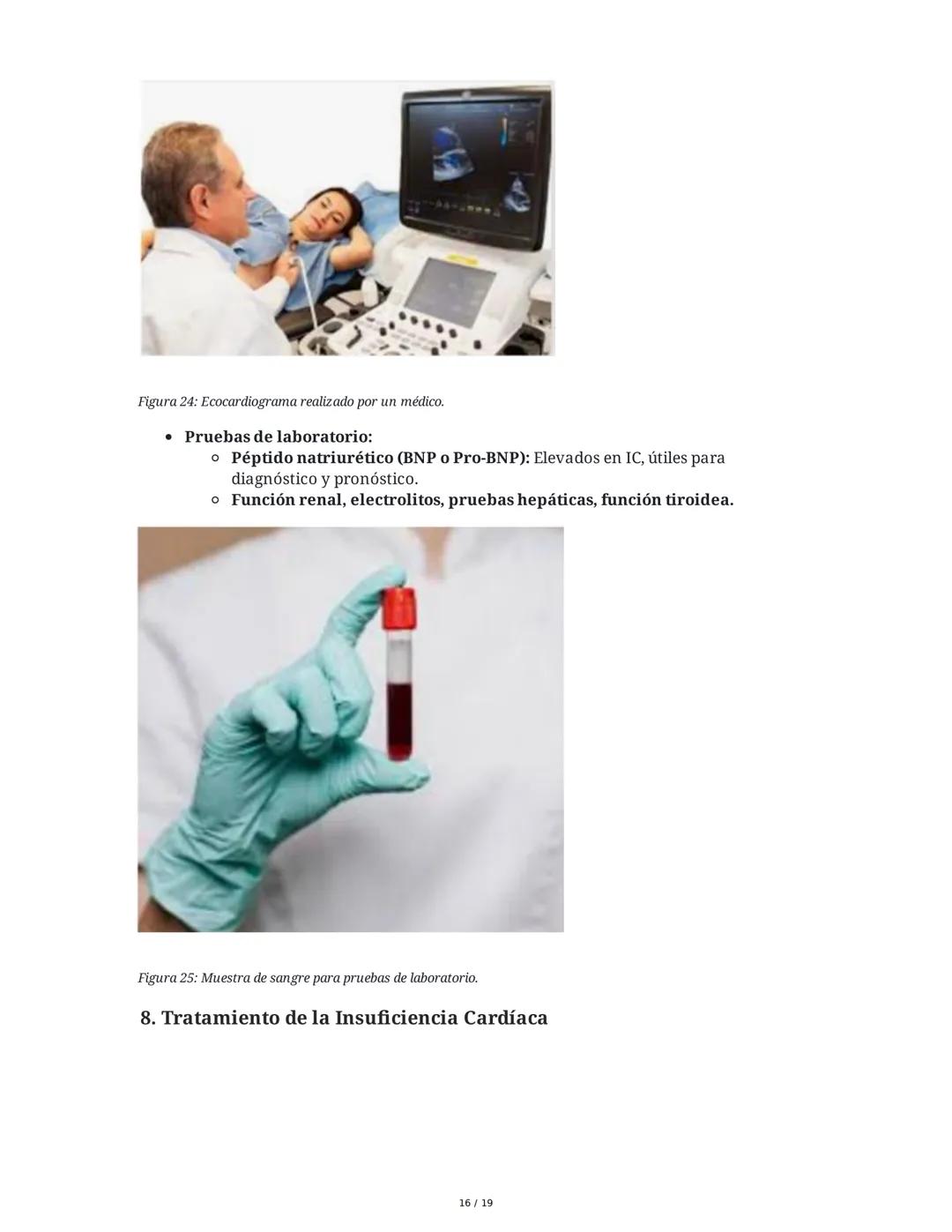 # Insuficiencia Cardiaca

## 1. Introducción y Definición

La insuficiencia cardiaca (IC) es un síndrome clínico complejo y una de las princ