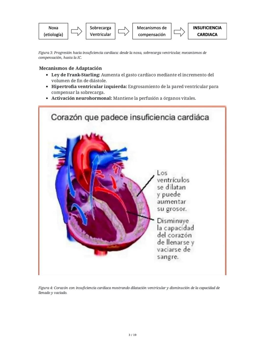 # Insuficiencia Cardiaca

## 1. Introducción y Definición

La insuficiencia cardiaca (IC) es un síndrome clínico complejo y una de las princ