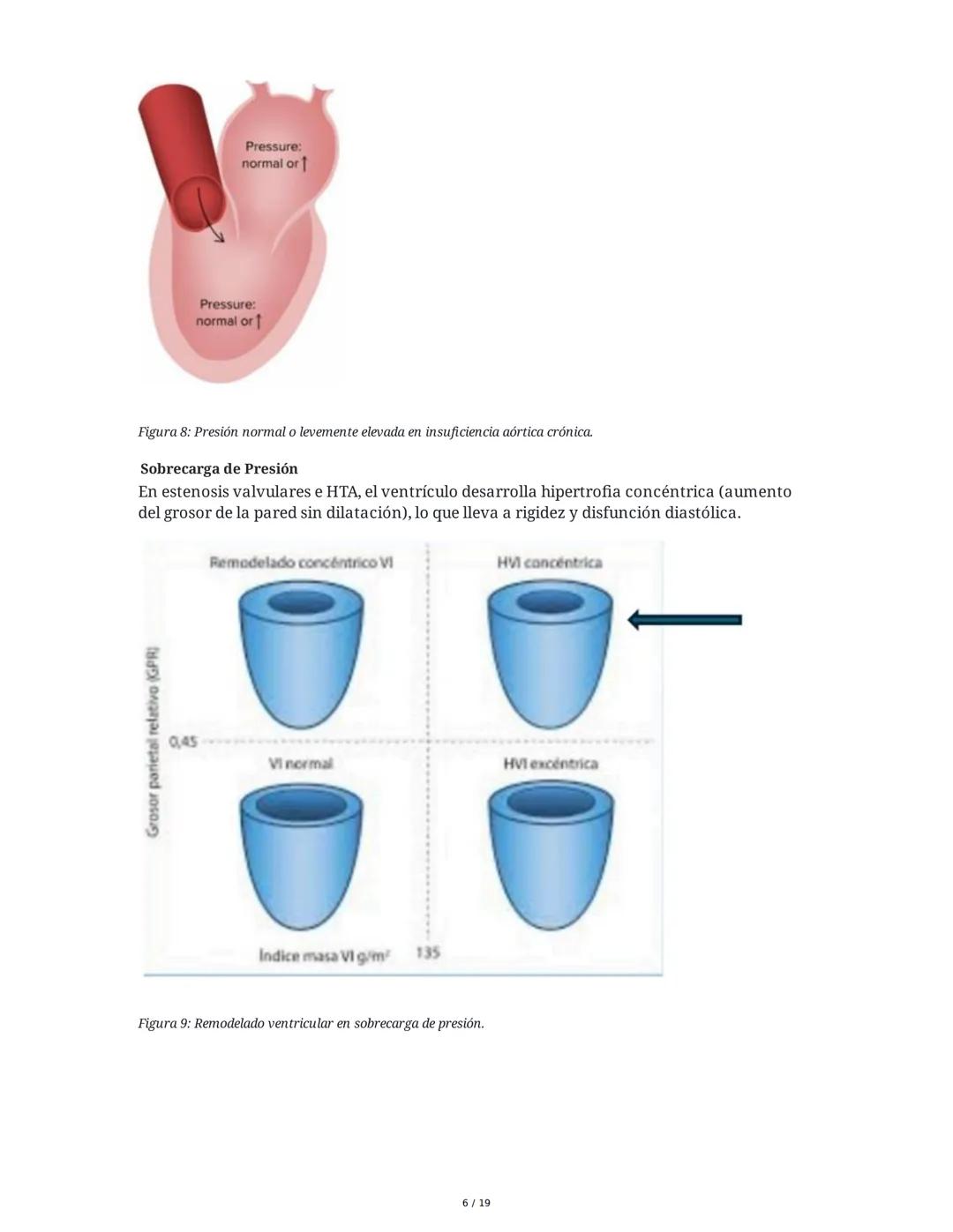 # Insuficiencia Cardiaca

## 1. Introducción y Definición

La insuficiencia cardiaca (IC) es un síndrome clínico complejo y una de las princ