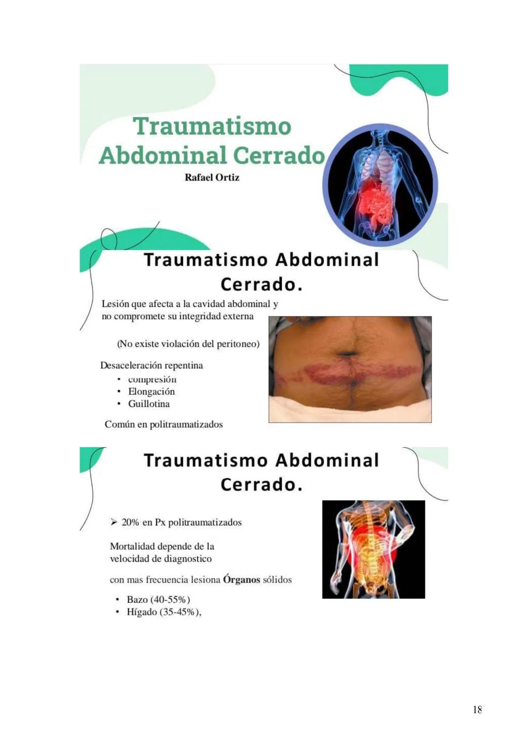 # ONCOLOGIA
4 --- OCR Start ---
Maturín, 24 de enero de 2024.
Oncologia básica.
Clase
Es el estudio de los tumores o neoplasias.
• Tumor: h