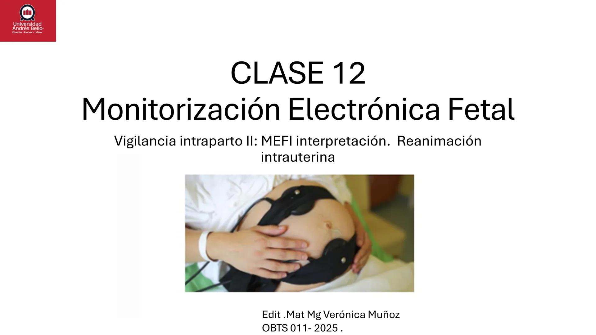 --- OCR Start ---
Universidad
Andrés Bello
Conectar-Innovar-Liderar
CLASE 12
Monitorización Electrónica Fetal
Vigilancia intraparto II: MEFI