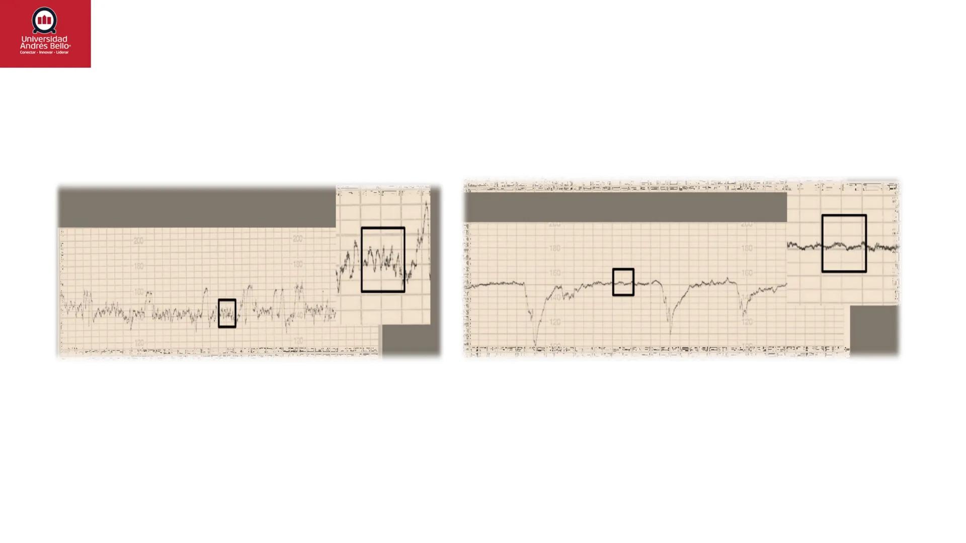 --- OCR Start ---
Universidad
Andrés Bello
Conectar-Innovar-Liderar
CLASE 12
Monitorización Electrónica Fetal
Vigilancia intraparto II: MEFI