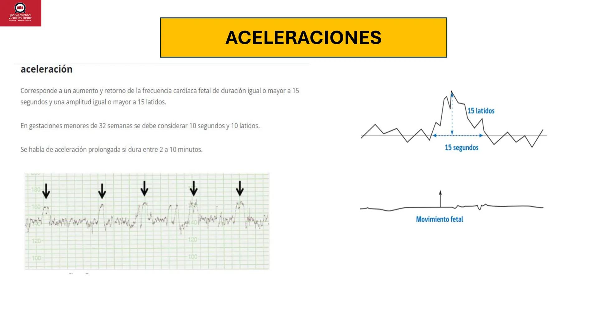 --- OCR Start ---
Universidad
Andrés Bello
Conectar-Innovar-Liderar
CLASE 12
Monitorización Electrónica Fetal
Vigilancia intraparto II: MEFI