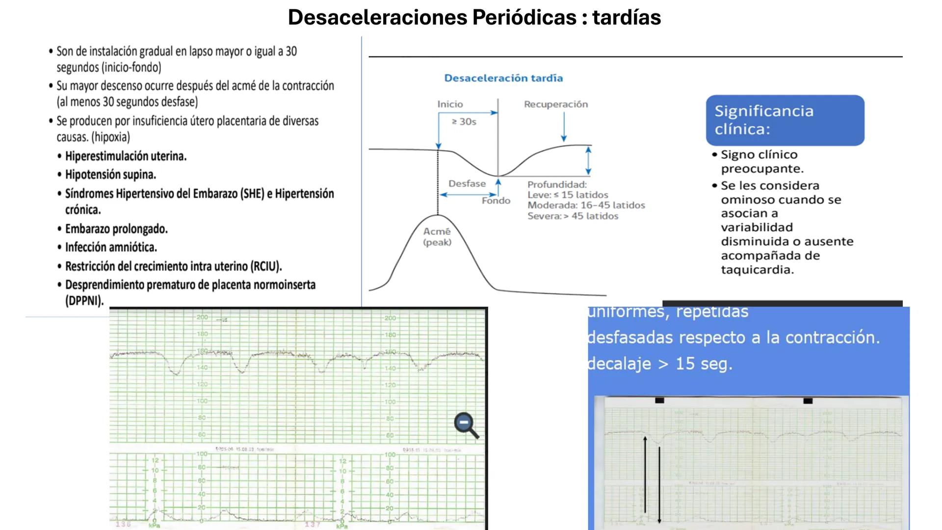 --- OCR Start ---
Universidad
Andrés Bello
Conectar-Innovar-Liderar
CLASE 12
Monitorización Electrónica Fetal
Vigilancia intraparto II: MEFI