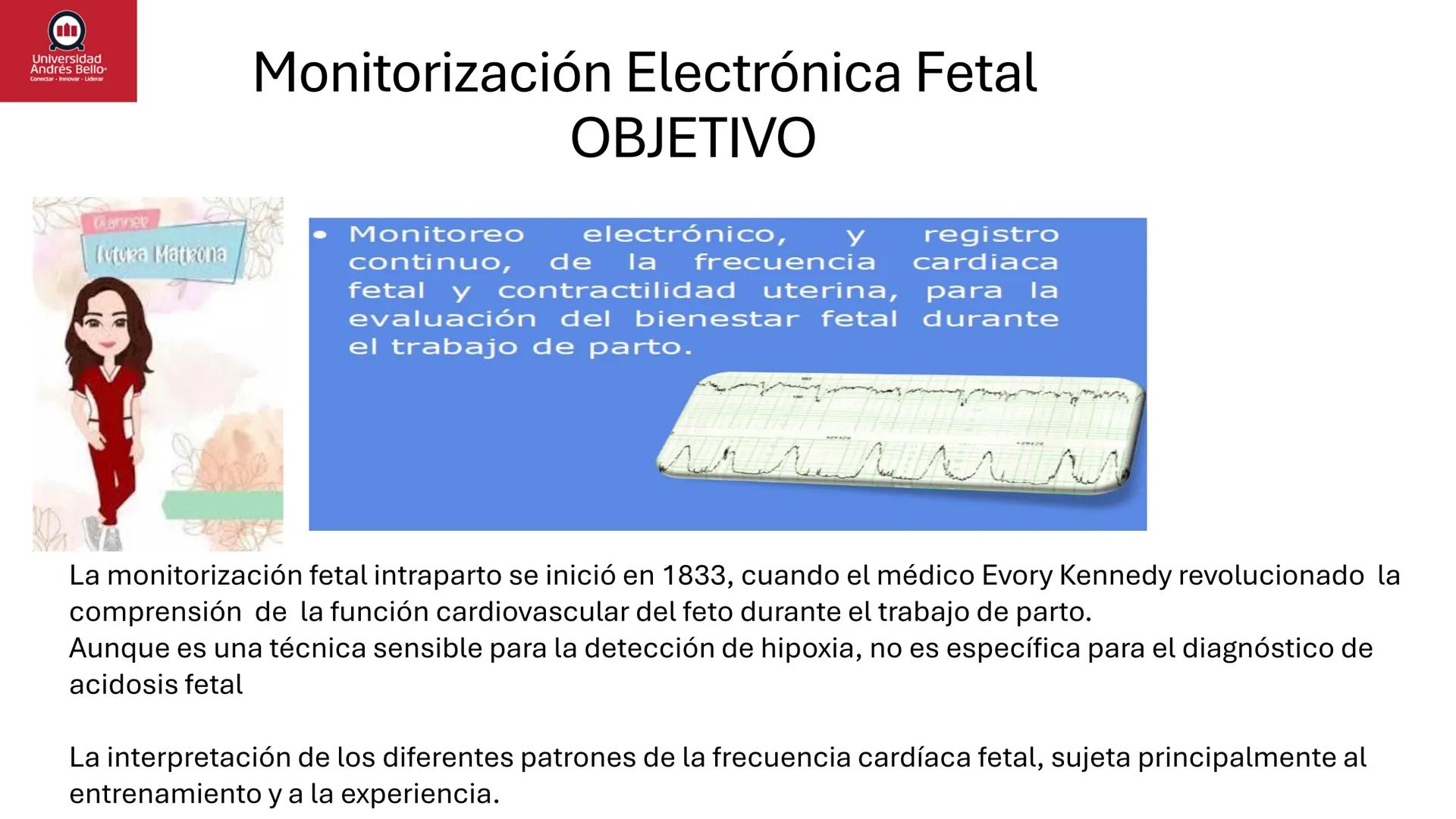 --- OCR Start ---
Universidad
Andrés Bello
Conectar-Innovar-Liderar
CLASE 12
Monitorización Electrónica Fetal
Vigilancia intraparto II: MEFI