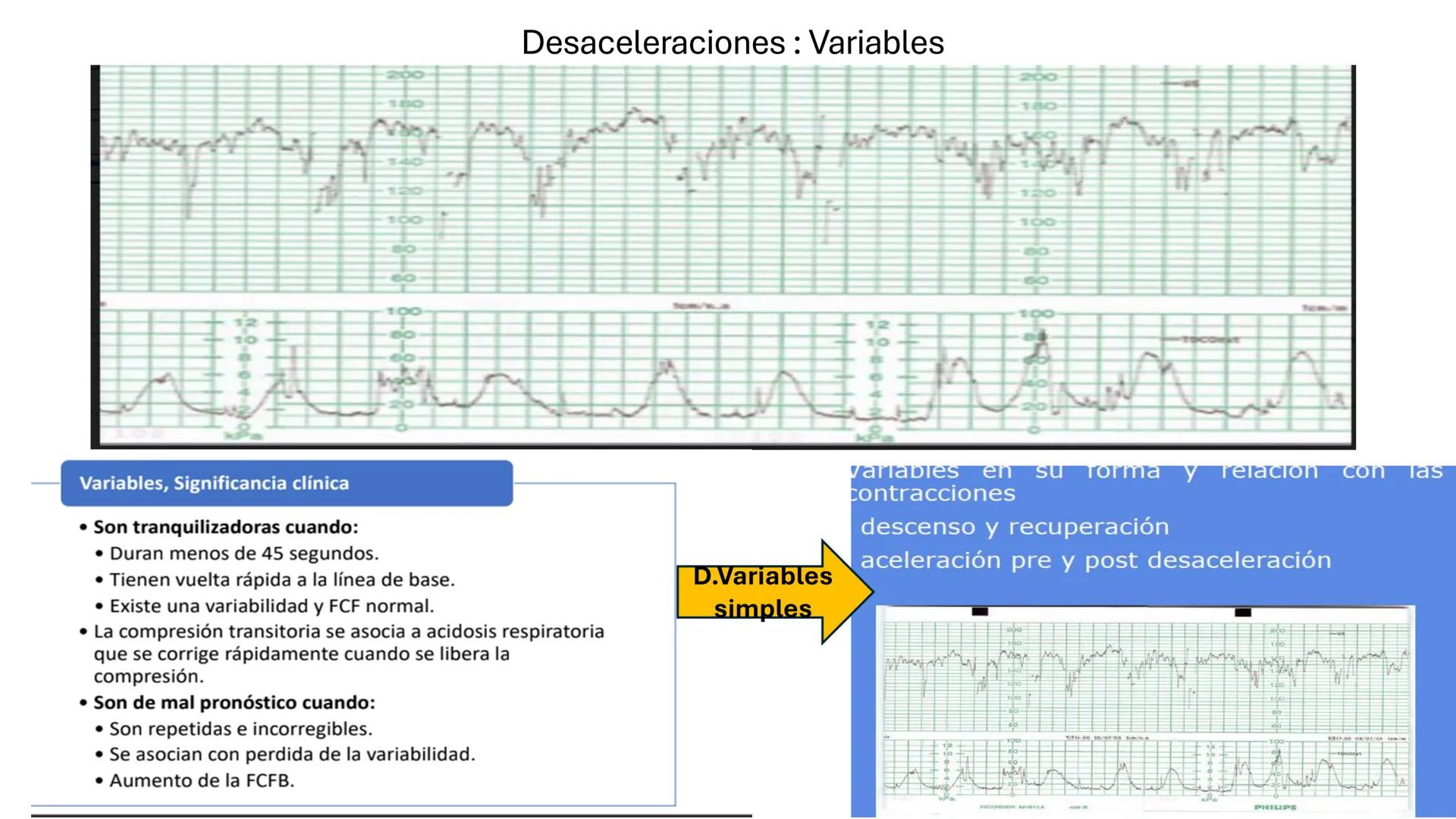 --- OCR Start ---
Universidad
Andrés Bello
Conectar-Innovar-Liderar
CLASE 12
Monitorización Electrónica Fetal
Vigilancia intraparto II: MEFI
