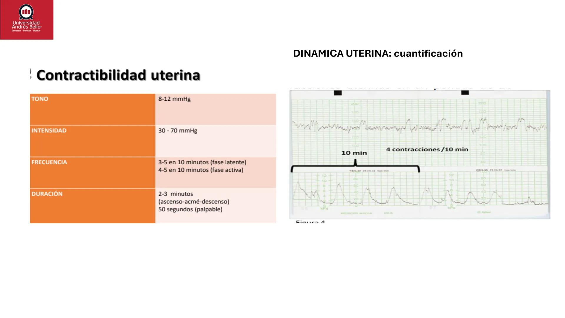 --- OCR Start ---
Universidad
Andrés Bello
Conectar-Innovar-Liderar
CLASE 12
Monitorización Electrónica Fetal
Vigilancia intraparto II: MEFI
