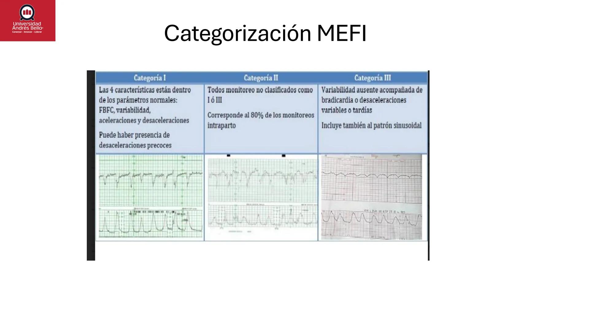 --- OCR Start ---
Universidad
Andrés Bello
Conectar-Innovar-Liderar
CLASE 12
Monitorización Electrónica Fetal
Vigilancia intraparto II: MEFI
