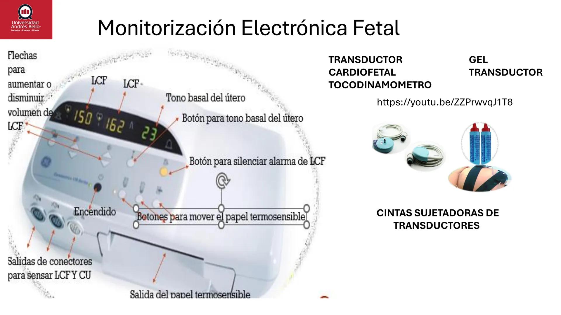 --- OCR Start ---
Universidad
Andrés Bello
Conectar-Innovar-Liderar
CLASE 12
Monitorización Electrónica Fetal
Vigilancia intraparto II: MEFI
