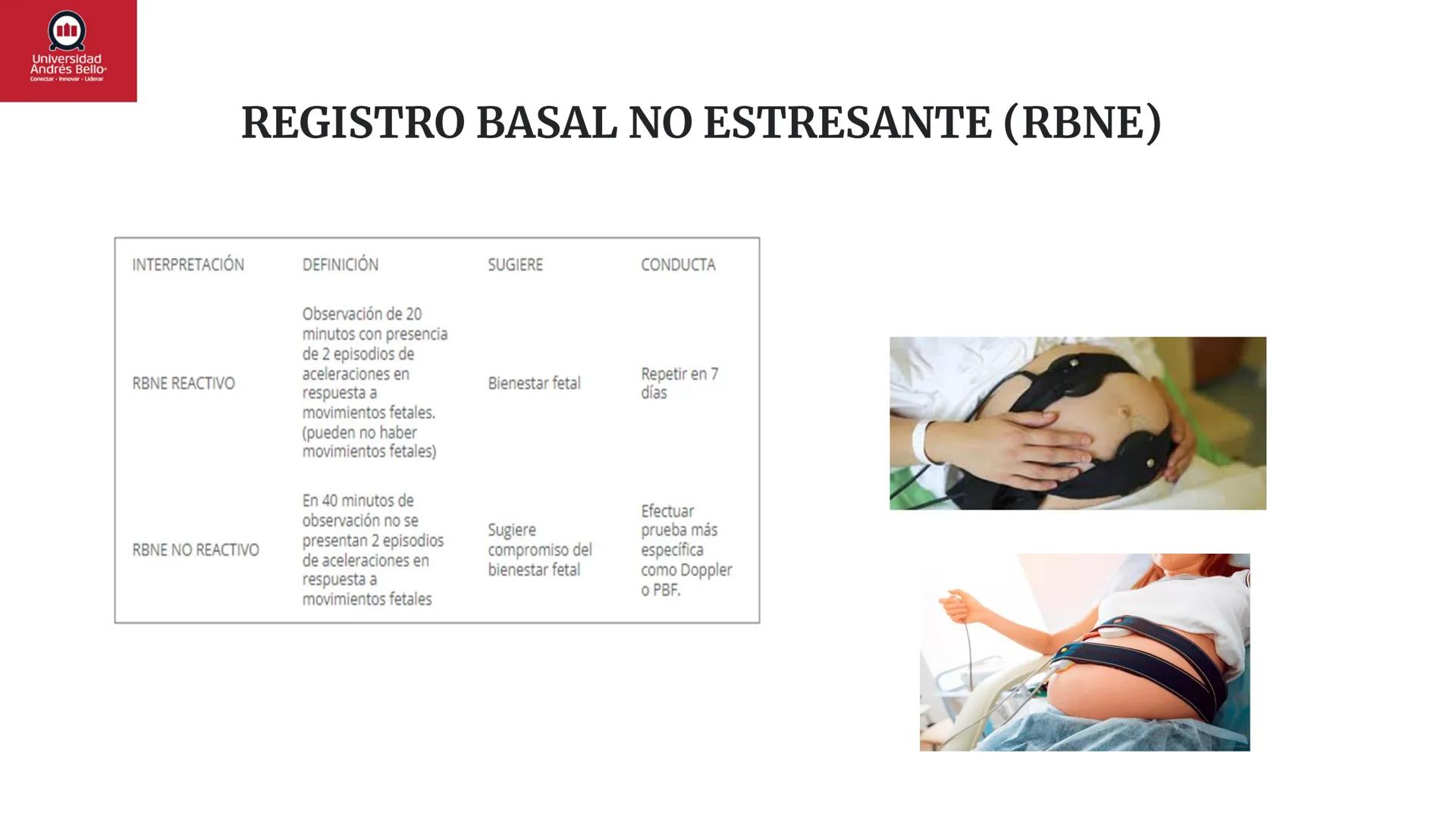 --- OCR Start ---
Universidad
Andrés Bello
Conectar-Innovar-Liderar
CLASE 12
Monitorización Electrónica Fetal
Vigilancia intraparto II: MEFI