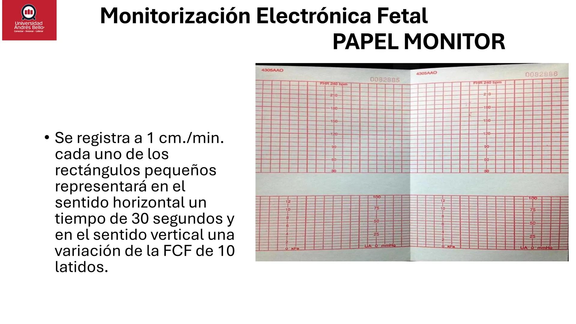 --- OCR Start ---
Universidad
Andrés Bello
Conectar-Innovar-Liderar
CLASE 12
Monitorización Electrónica Fetal
Vigilancia intraparto II: MEFI