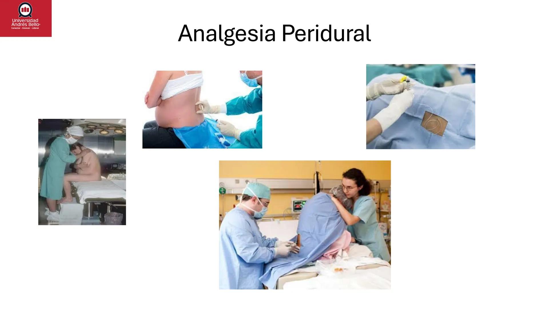 --- OCR Start ---
Universidad
Andrés Bello
Conectar-Innovar-Liderar
CLASE 12
Monitorización Electrónica Fetal
Vigilancia intraparto II: MEFI