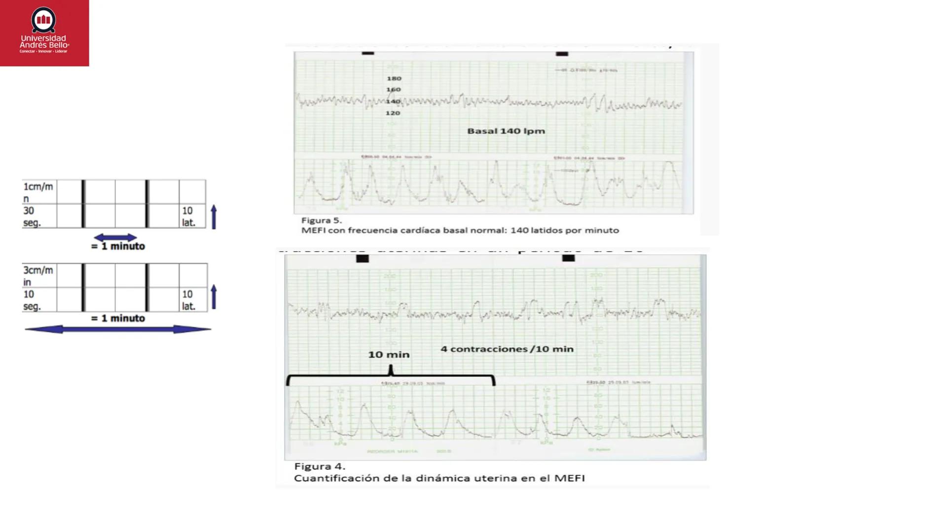 --- OCR Start ---
Universidad
Andrés Bello
Conectar-Innovar-Liderar
CLASE 12
Monitorización Electrónica Fetal
Vigilancia intraparto II: MEFI